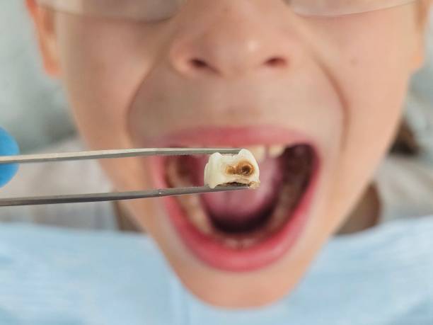 Best After-Hours Emergency Dentist in Tchula, MS